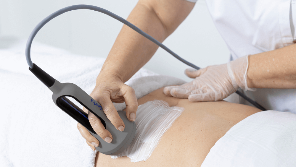 Ocarine®: The Thermodynamic Technology That Reduces Localized Fat