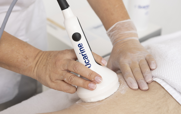 Técnica de aplicación en Flancos Ocarine®