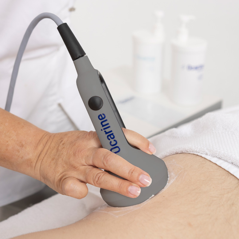 Ocarine® Protocol The Thermodynamic Approach to Cellulite Removal: Beyond Traditional Methods