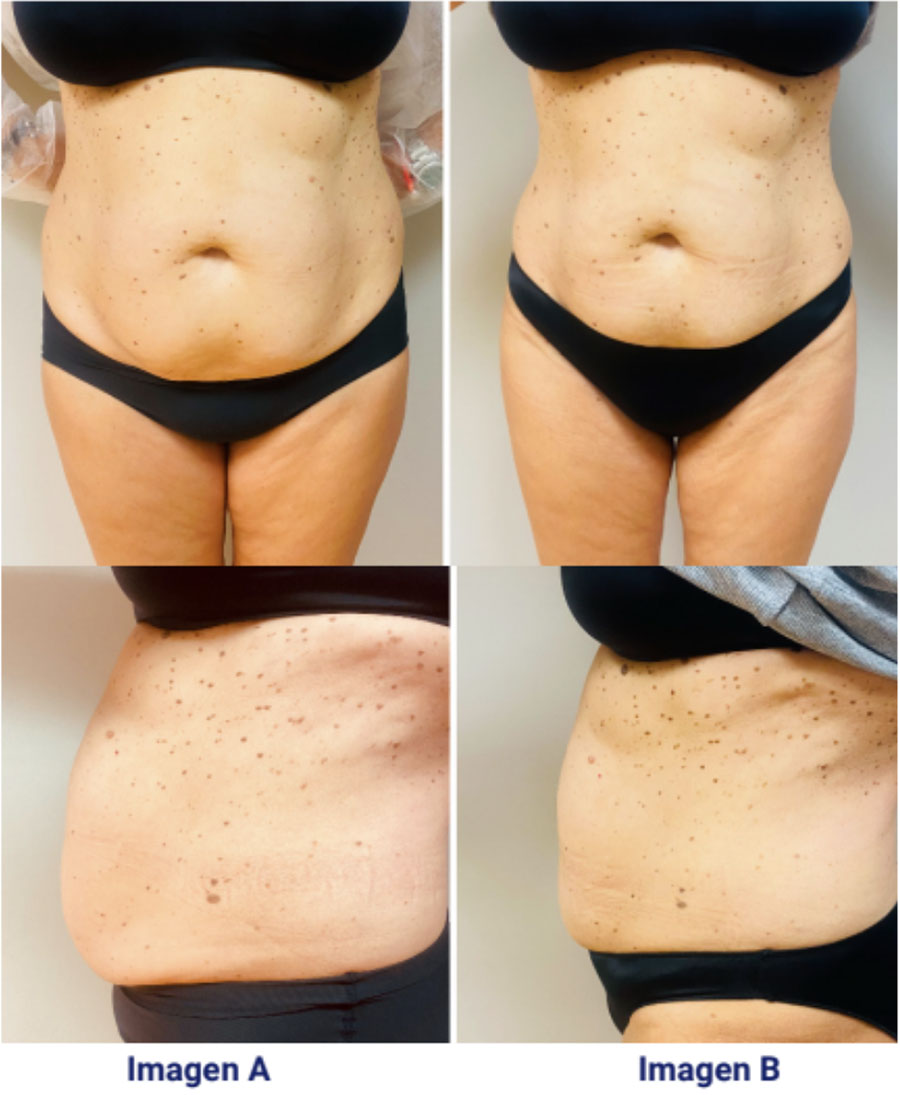 Resultados Ocarine® Resultados Ocarine®