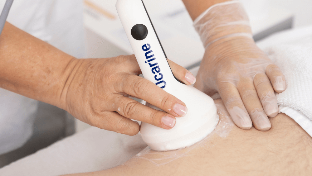 ocarine-supera-radiofrecuencia-cavitacion-laser