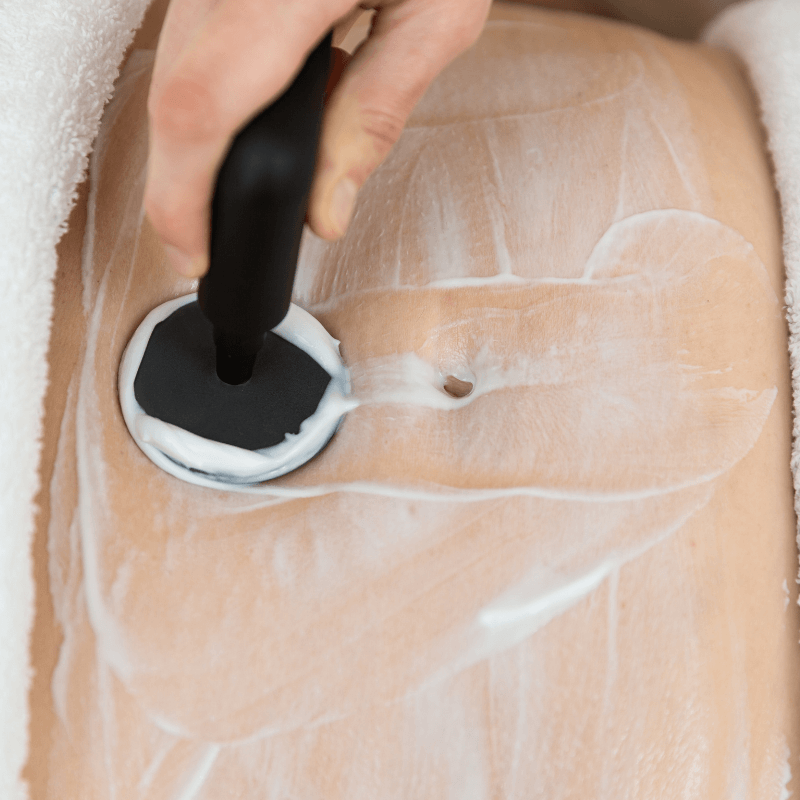 ocarine-supera-sesiones-radiofrecuencia